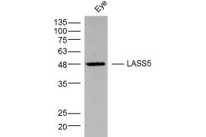 Mouse Eye lysates probed with LASS5 Polyclonal Antibody, Unconjugated  at 1:300 dilution and 4˚C overnight incubation.