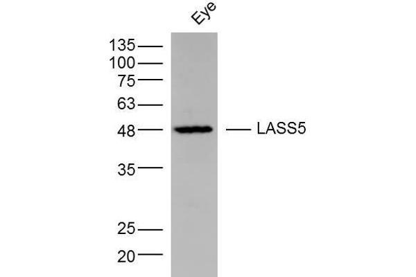 LASS5 Antikörper  (AA 101-200)
