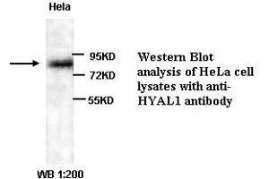Image no. 1 for anti-Hyaluronidase-1 (HYAL1) (Internal Region) antibody (ABIN791003) (HYAL1 antibody  (Internal Region))