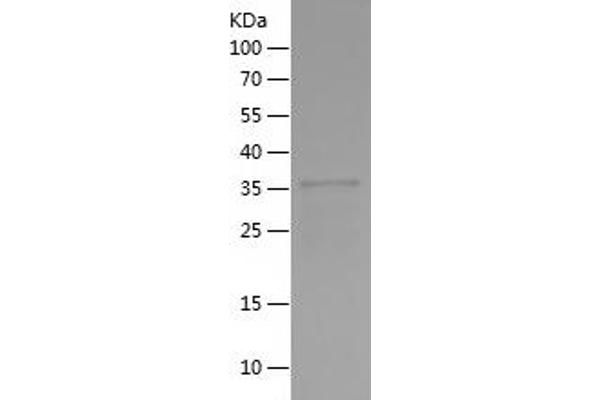 NR2E3 Protein (AA 113-245) (His-IF2DI Tag)