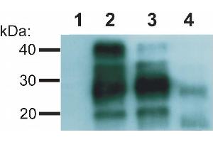 Western blotting analysis of Creutzfeld-Jakob disease (CJD) negative (lane 1, 2) and CJD positive (lane 3, 4) human brain material using anti-PrP antibody (clone EM-20).