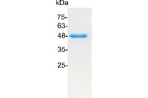 Enolase 1 (ENO1) protein (His tag)