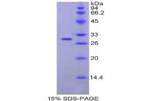 SDS-PAGE (SDS) image for Plastin 3 (PLS3) (AA 234-475) protein (His tag) (ABIN1877823) (Plastin 3 Protein (PLS3) (AA 234-475) (His tag))