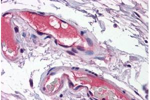 Human Vessels: Formalin-Fixed, Paraffin-Embedded (FFPE) (Osteopontin antibody  (N-Term))