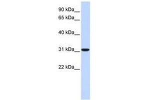 Image no. 1 for anti-Carbonic Anhydrase VIII (CA8) (C-Term) antibody (ABIN6740749) (CA8 antibody  (C-Term))