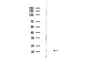 anti-Mitochondrial Ribosomal Protein L20 (MRPL20) (C-Term) antibody