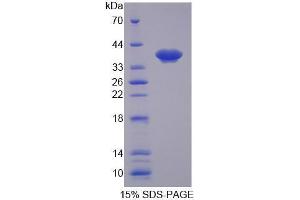 Image no. 1 for Solute Carrier Family 25, Member 39 (SLC25A39) (AA 9-347) protein (His tag) (ABIN6239634) (SLC25A39 Protein (AA 9-347) (His tag))