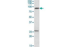 SLC4A11 polyclonal antibody  (0. (SLC4A11 antibody  (Internal Region))