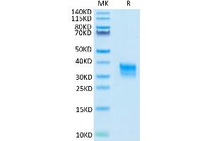 FCGR2A Protein (AA 28-208) (His tag)