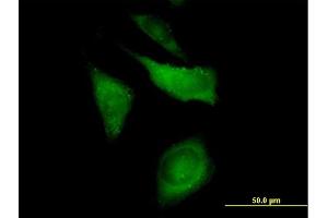 Immunofluorescence of purified MaxPab antibody to CAP1 on HeLa cell. (CAP1 antibody  (AA 1-475))