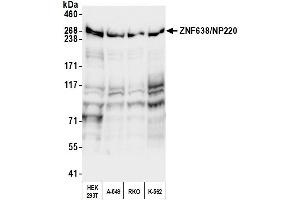 Western Blotting (WB) image for anti-Zinc Finger Protein 638 (ZNF638) (AA 225-275) antibody (ABIN7539900)