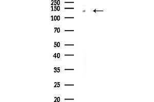 anti-Sal-Like 1 (SALL1) (N-Term) antibody