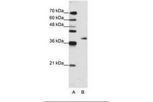 ADAT1 抗体  (AA 390-439)