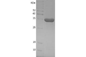 Western Blotting (WB) image for Mitogen-Activated Protein Kinase Kinase 6 (MAP2K6) (AA 6-334) protein (His tag) (ABIN7124002) (MAP2K6 Protein (AA 6-334) (His tag))