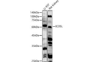 Western blot analysis of extracts of various cell lines, using ICOSL antibody (ABIN6130065, ABIN6142131, ABIN6142132 and ABIN6222879) at 1:500 dilution. (ICOSLG antibody  (AA 19-256))