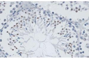 Immunohistochemistry of paraffin-embedded Mouse testis using MSH6 Polyclonal Antibody at dilution of 1:100 (40x lens). (MSH6 antibody)
