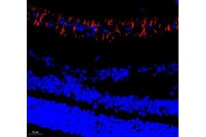 Immunofluorescence of paraffin embedded mouse eye using Cep78 (ABIN7073432) at dilution of 1:650 (400x lens) (CEP78 antibody)