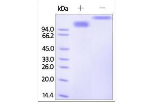 SDS-PAGE (SDS) image for Scavenger Receptor Class B, Member 1 (SCARB1) (AA 33-443) protein (Fc Tag) (ABIN2181726)