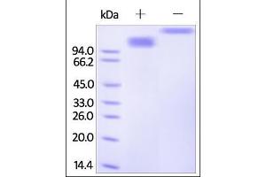 Human SCARB1, Fc Tag on SDS-PAGE under reducing (R) and no-reducing (NR) conditions. (SCARB1 Protein (AA 33-443) (Fc Tag))