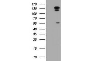 Western Blotting (WB) image for anti-ATP/GTP Binding Protein 1 (AGTPBP1) (AA 368-753) antibody (ABIN1491462) (AGTPBP1 antibody  (AA 368-753))