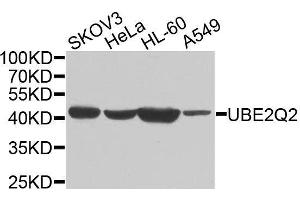 Western blot analysis of extracts of various cell lines, using UBE2Q2 antibody. (UBE2Q2 antibody  (AA 1-150))