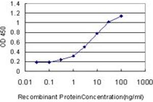 Detection limit for recombinant GST tagged CA1 is approximately 0. (CA1 antibody  (AA 1-261))