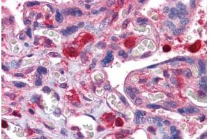 Human Placenta: Formalin-Fixed, Paraffin-Embedded (FFPE) (GDI2 antibody  (AA 1-197))