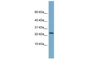 LRRC20 antibody used at 1 ug/ml to detect target protein. (LRRC20 antibody  (Middle Region))