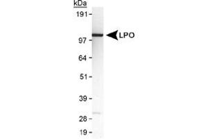 Western blot analysis of LPO in MDA-MB-231 cell lysate using LPO polyclonal antibody .