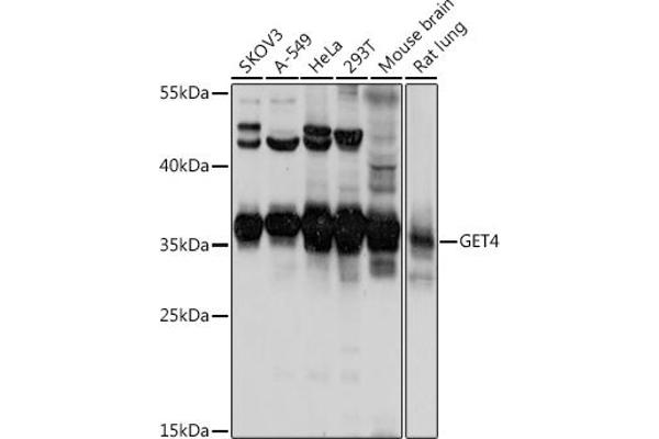 Chromosome 7 Open Reading Frame 20 (C7orf20) (AA 1-327) antibody