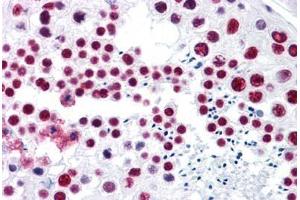 Human Testis: Formalin-Fixed, Paraffin-Embedded (FFPE) (SNRPA1 antibody  (AA 1-283))