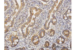 Immunoperoxidase of monoclonal antibody to ROCK2 on formalin-fixed paraffin-embedded human small Intestine. (ROCK2 antibody  (AA 1279-1388))