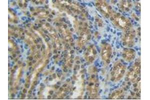 Detection of AST in Rat Kidney Tissue using Polyclonal Antibody to Aspartate Aminotransferase (AST)
