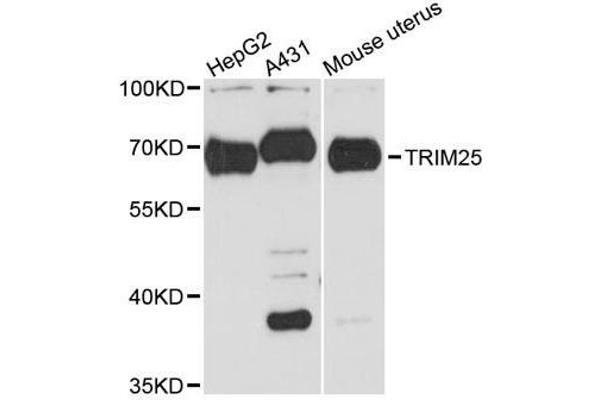 TRIM25 antibody  (AA 100-400)