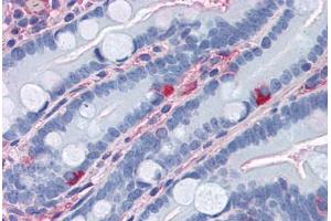 Human Small Intestine (formalin-fixed, paraffin-embedded) stained with APOA1 antibody ABIN364438 at 10 ug/ml followed by biotinylated anti-mouse IgG secondary antibody ABIN481714, alkaline phosphatase-streptavidin and chromogen. (APOA1 antibody)