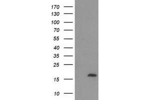 HEK293T cells were transfected with the pCMV6-ENTRY control (Left lane) or pCMV6-ENTRY C2orf40 (Right lane) cDNA for 48 hrs and lysed. (C2orf40 antibody)