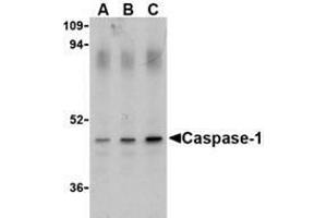 Western blot analysis of Caspase-1 in HeLa cell lysate with AP30188PU-N Caspase-1 antibody (IN) at (A) 0. (Caspase 1 antibody  (Intermediate Domain))