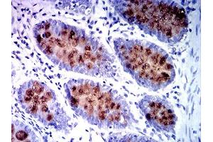 Immunohistochemical analysis of paraffin-embedded colon tissues using MUC2 mouse mAb with DAB staining. (MUC2 antibody  (AA 4373-4557))