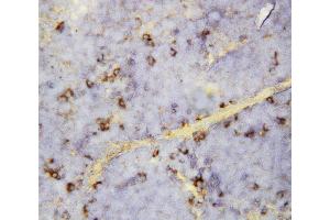 Anti-CXCL16 antibody, IHC(P) IHC(P): Mouse Spleen Tissue (CXCL16 antibody  (Middle Region))