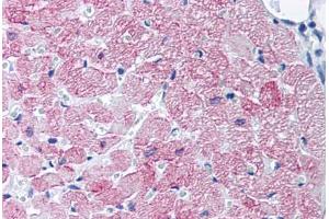 Human Heart, Cardiac Myocytes (formalin-fixed, paraffin-embedded) stained with SLC2A4 antibody ABIN218433 at 10-20 ug/ml followed by biotinylated goat anti-rabbit IgG secondary antibody ABIN481713, alkaline phosphatase-streptavidin and chromogen. (GLUT4 antibody)