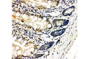 Anti-NFkB p100/p52 antibody, IHC(P) IHC(P): Rat Intestine Tissue (NFKB2 antibody  (N-Term))