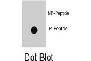 Dot blot analysis of INSR (phospho Y1185) polyclonal antibody  on nitrocellulose membrane.