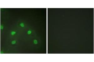 Immunofluorescence analysis of HeLa cells, using hnRNP L Antibody. (HNRNPL antibody  (AA 61-110))
