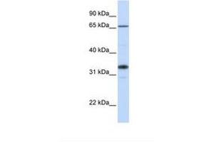 Image no. 1 for anti-UDP-Gal:betaGlcNAc beta 1,3-Galactosyltransferase, Polypeptide 1 (B3GALT1) (AA 252-301) antibody (ABIN6738585)