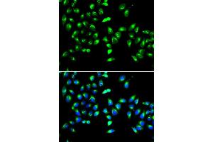 Immunofluorescence analysis of HeLa cell using GALNT2 antibody. (GALNT2 antibody)