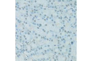 Immunohistochemistry of paraffin-embedded rat pancreas using PDC antibody (ABIN6293719) at dilution of 1:100 (40x lens).