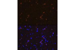 Immunofluorescence analysis of rat brain using NMD Rabbit mAb (ABIN7267417) at dilution of 1:100 (40x lens). (GRIN1/NMDAR1 antibody)