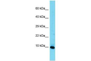Western Blotting (WB) image for anti-High Mobility Group Nucleosomal Binding Domain 3 (HMGN3) (Middle Region) antibody (ABIN2788959) (HMGN3 antibody  (Middle Region))