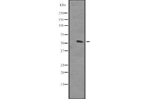 Western blot analysis of HOMEZ expression in Human placenta lysate ,The lane on the left is treated with the antigen-specific peptide. (HOMEZ antibody  (Internal Region))