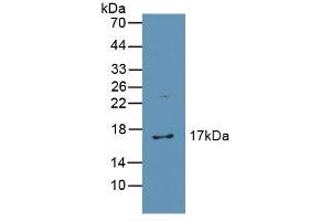 Figure. (Catalase antibody  (AA 32-167))